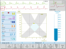 IKG CardioScreen 1000 software - terapeutické zobrazení