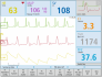 IKG CardioScreen 2000 software - monitor křivek a základních hodnot