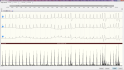 holter EKG software - příprava analýzy