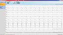 klidové EKG - software snímání 10 sec EKG