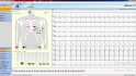 klidové EKG obrazovka pro kontrolu kvality signálu