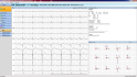 klidové EKG - software vyhodnocení